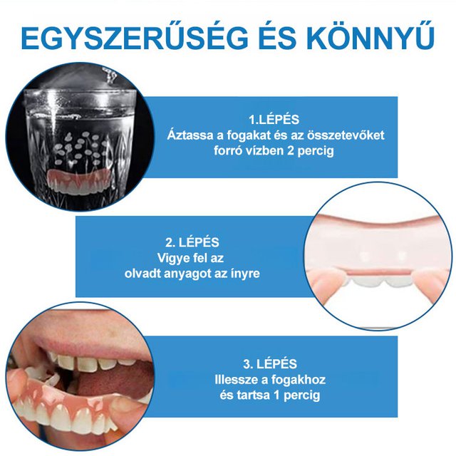 ORALHOE Fogmódosító fogsor fogszabályozó