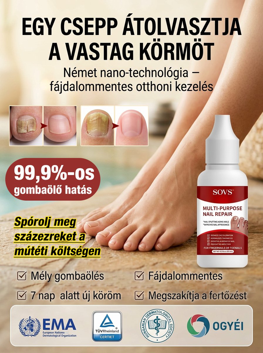 【Gombaellenes】Körömgomba kezelő folyadék