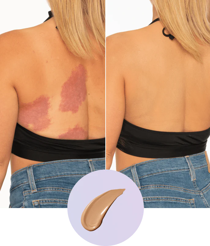 💜Utolsó nap – vegyél 1-et, kapsz 1-et ingyen!💜✨Body Perfector – vízálló, könnyű és hibátlan testfesték